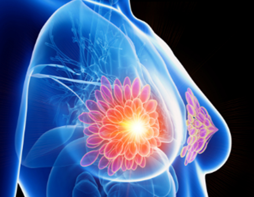 3D illustration of breast tissue used in mammogram screening