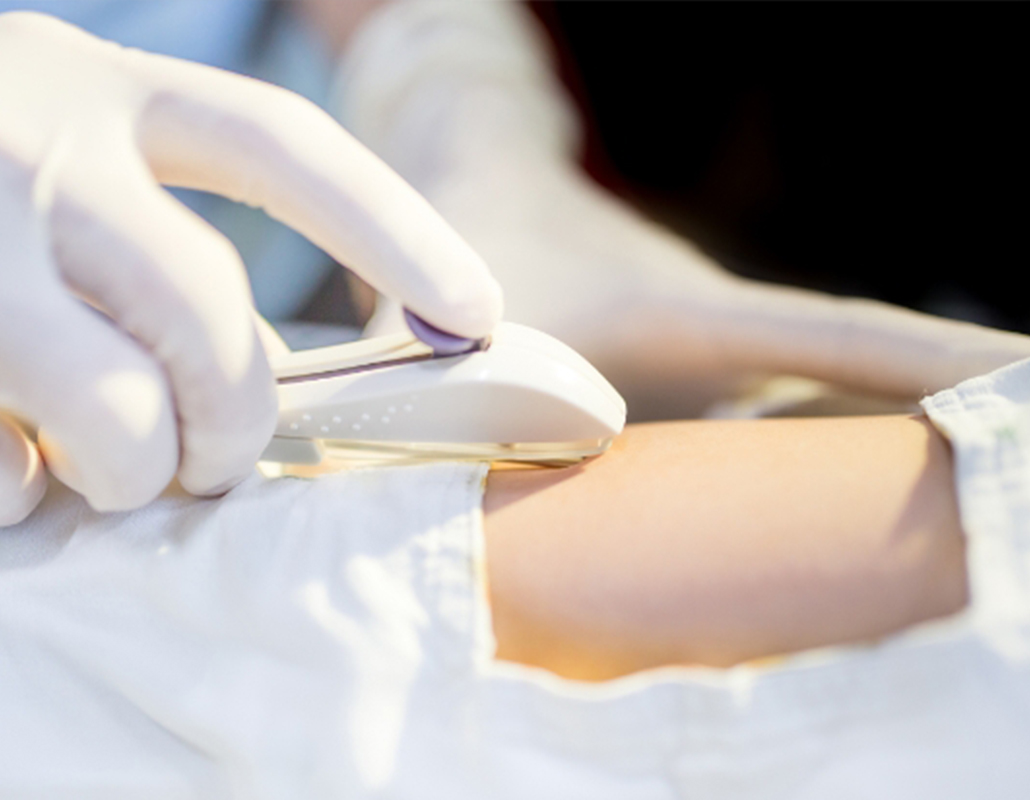 Close-up of medical device used for contraception procedure