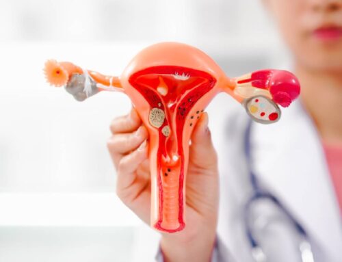 What Is the Acessa Procedure for Fibroids?